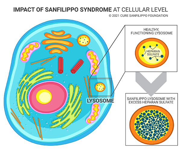 Impact of Sanfilippo on cellular lysosome - copyright 2021 Cure Sanfilippo Foundation